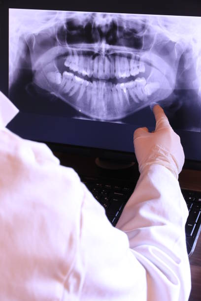 Best Emergency Dentist for Lost Fillings or Crowns in East Niles, CA