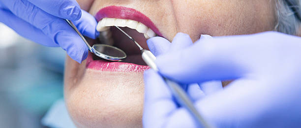 Best Emergency Dentist for Knocked-Out Tooth in East Niles, CA